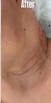 before&after
