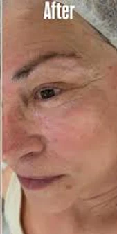 before&after