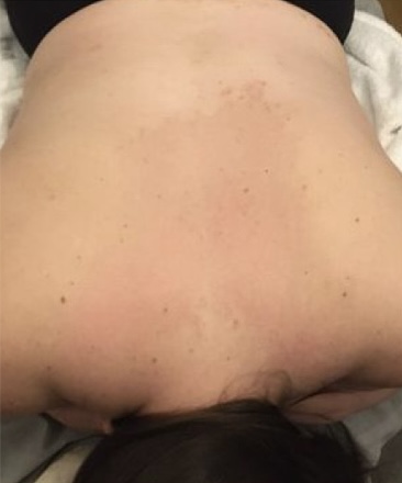 Before&After