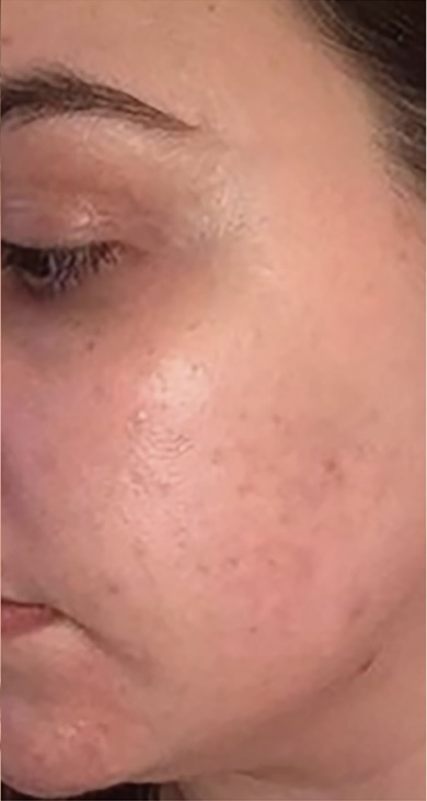 Before&After