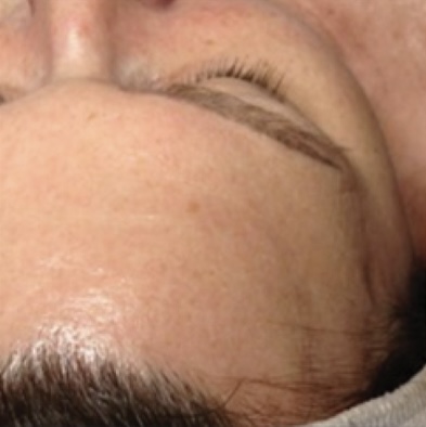 Before&After