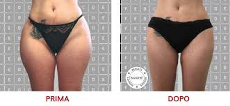 ICOONE LASER MED