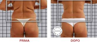 ICOONE LASER MED
