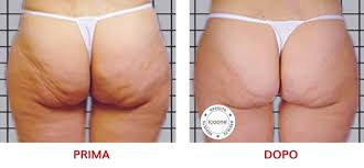 ICOONE LASER MED
