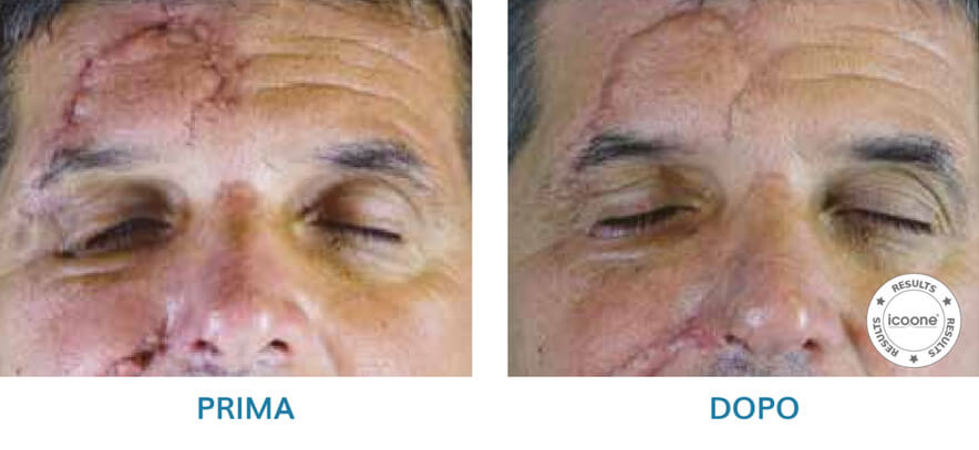 ICOONE LASER MED ICOONE LASER MED